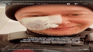 Orduya katılan Ukraynalı müzisyen, Rus saldırılarında yaralandı