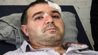 ‘Beni taciz, rahatsız ediyorsun diyerek saldırdığı aile hekiminin burnunu kırdı