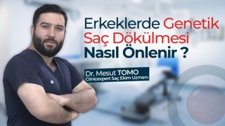 Erkeklerde Genetik Saç Dökülmesi Nasıl Önlenir?