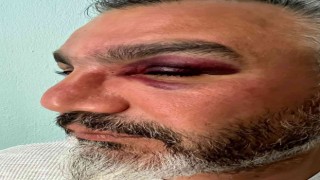 Eşinin memleketini tanımak isteyen gurbetçi, trafik magandalarının kurbanı oldu