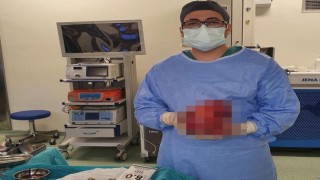 Karnından futbol topu büyüklüğünde tümör çıktı