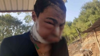 Yakalandığı hastalık kabusu olmuştu, hayatını kaybetti