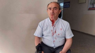 Davada ortalık karıştı, kavgayı ayırmaya çalışan avukat da darp edildi