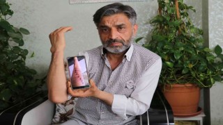 Elindeki şişlik için gittiği hastanede kolundan 2 kez yanlış ameliyat oldu iddiası
