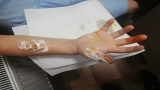 Kadıköyde hastanede MR çekilen küçük kızın parmakları ve kolu yandı