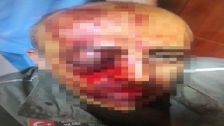 Orman muhafaza memurunu darbeden 4 şüpheli gözaltına alındı