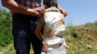 Bingölde 6 yaşındaki çocuk köpeklerin saldırısına uğradı