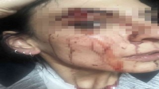 Esenyurtta site içerisinde alkol aldığı iddia edilen kadınları tekme tokat dövdüler