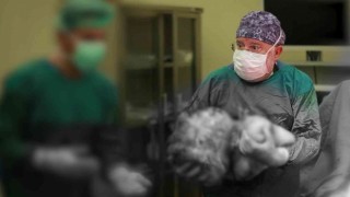 Kadın hastanın karnından 16,9 kiloluk dev kitle çıktı, 40 yıllık doktor bile şaşırdı