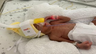 850 gramlık Birsen Asel bebek, 100 günde yaşama tutundu