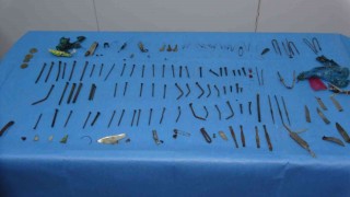 Doktorları şaşkına çeviren ameliyat: Midesinden 158 parça metal çıktı