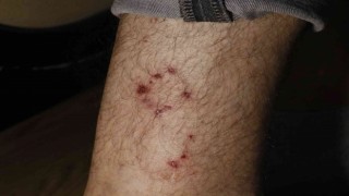 Ailesiyle evine giderken köpeklerin saldırısına uğradı