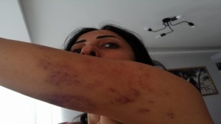 Öz annesi tarafından satıldı, boşandığı eşi 5 yıl şiddet uyguladı