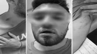 Tıp Fakültesi öğrencilerine emlakçıdan darp ve tehdit iddiası