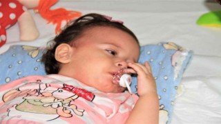 13 aylık bebeğin böbreğinden çıkan taş şaşırttı