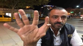 Elazığda 11 parmaklı adam görenleri hayrete düşürüyor