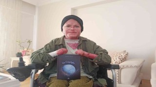 Kelebek hastası Büşra günlüklerini kitap haline getirdi