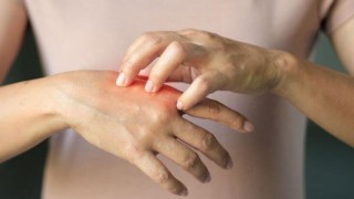 Bu cilt hastalıkları en çok kış mevsimini seviyor!