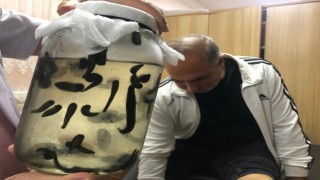 Hastalar 5 bin yıllık tedavi yöntemleriyle şifa buluyor