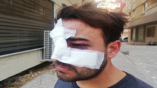 Hatayda istek şarkıyı bilmeyen müzisyenin yüzünde şişe kırdılar