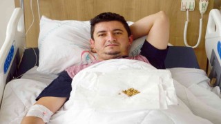Vücudu sürekli taş üretiyor