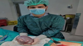 Yumurtalık kanserine yakalanan hastadan 17 santimetrelik tümör çıkarıldı