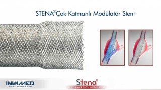 Aort anevrizmasına STENA stent tedavisi