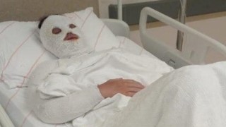 Eski nişanlısına kimyasal sıvı atan kişinin iddianamesi kabul edildi