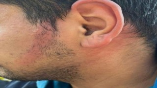 Ümraniyede İETT otobüsünün klima borusu patladı, bir yolcunun yüzü yandı