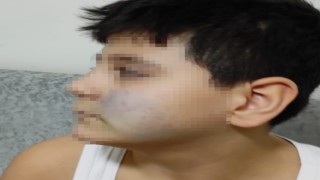 Başkentte akran şiddeti iddiası