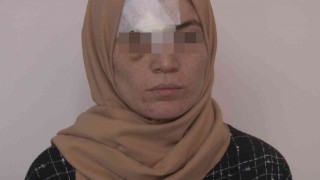 Kocası darp etti, 8 dikiş atıldı
