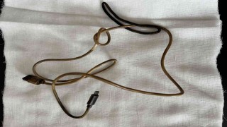 Kusma ve karın ağrısı şikayetiyle doktora giden çocuğun karnından telefon şarj kablosu çıktı