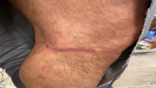 Çankayada başıboş köpekler vatandaşın kıyafetlerini parçaladı