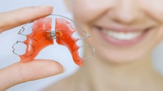 Prof. Dr. Ramoğlu: Ortodontik tedavi her yaşta mümkün