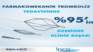 Trellis Tromboliz Sistemi ile DVT tedavisinde yüzde 95in üzerinde klinik başarı sağlanıyor