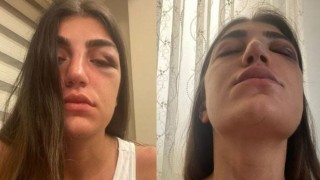Manken Gizem Akbaşın darp edilmesine ilişkin davada sanığa 1 yıl hapis talebi