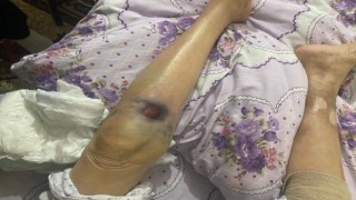Ankarada iki ay önce darp edildiği öne sürülen yaşlı kadın hastanede öldü