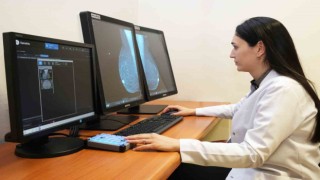 Meme kanseri tanısında yeni teknoloji 3D tomosentez mamografi cihazı SANKOda
