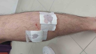 Mersinde sokak köpekleri belediye çalışanına saldırıp ısırdı