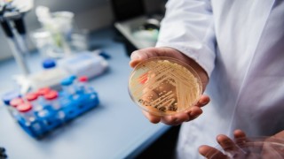 Ölümcül mantarla, yapay zeka desteği ile mücadele edilecek