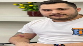 Fatihte bir kişi evinin penceresinden kavgaya müdahalede bulunan polisin açtığı uyarı ateşiyle yüzünden yaralandı