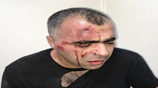 BİGACEM Başkanı Aygüle saldırıya ilişkin 1i polis 2 kişi gözaltına alındı
