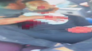 Şanlıurfada akraba iki aile arasında silahlı kavga: 1i ağır 5 yaralı
