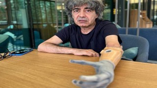 Meslektaşlarından gazeteci arkadaşlarına biyonik kol