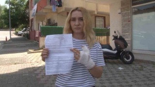 Sultanbeylide X-Ray krizi: İş arkadaşının parmağını ısırdı