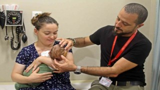 Pusetten düşüp kafatası kırılan 1 aylık bebek, başarılı ameliyatla hayata tutundu