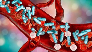 Dr. Yağız; “Sepsis önlenebilir bir hastalıktır”