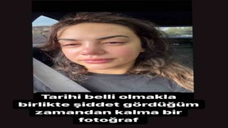 Ece Ronaya eski eşinden şiddet