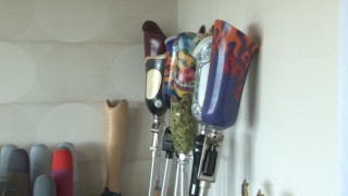 Kırşehirli iş adamı Düger, 20 depremzedeye ücretsiz protez temini gerçekleştirdi