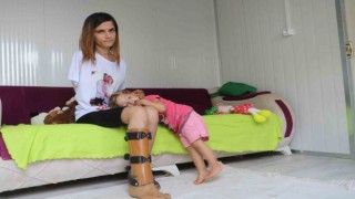 Depremde kaybetmişti: Kızına sarılmak için biyonik kol istiyor